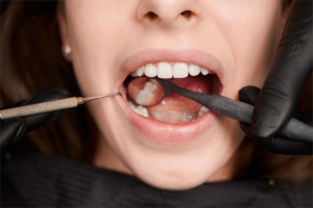 4 causas comunes de halitosis y cómo combatirla
