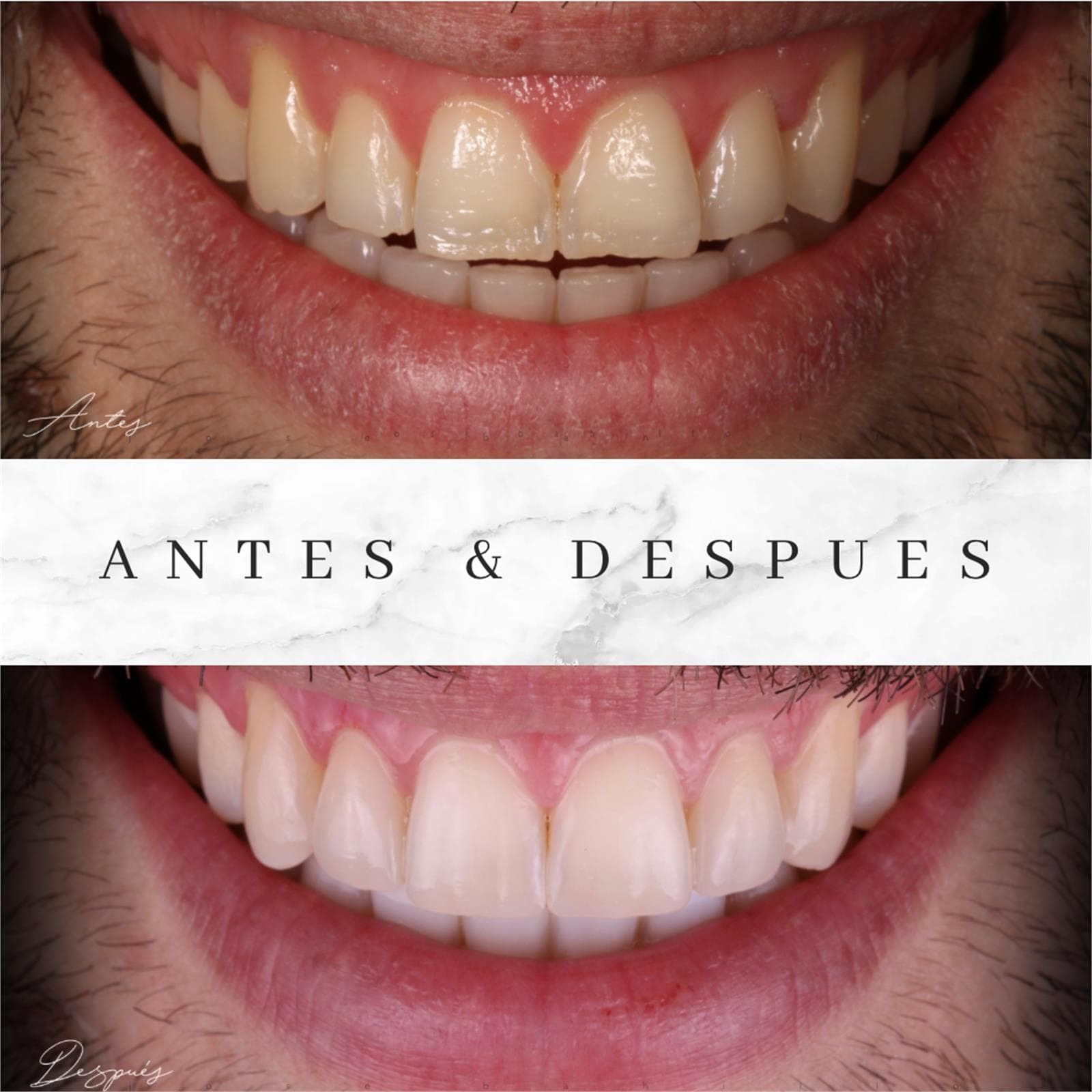 Estética Dental - Imagen 1