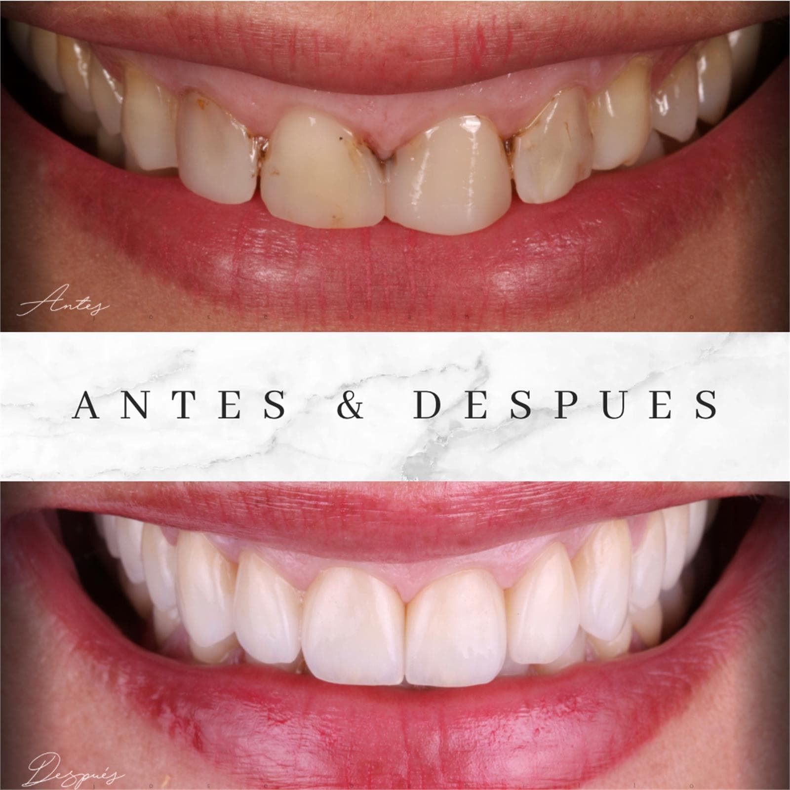 Estética Dental - Imagen 2
