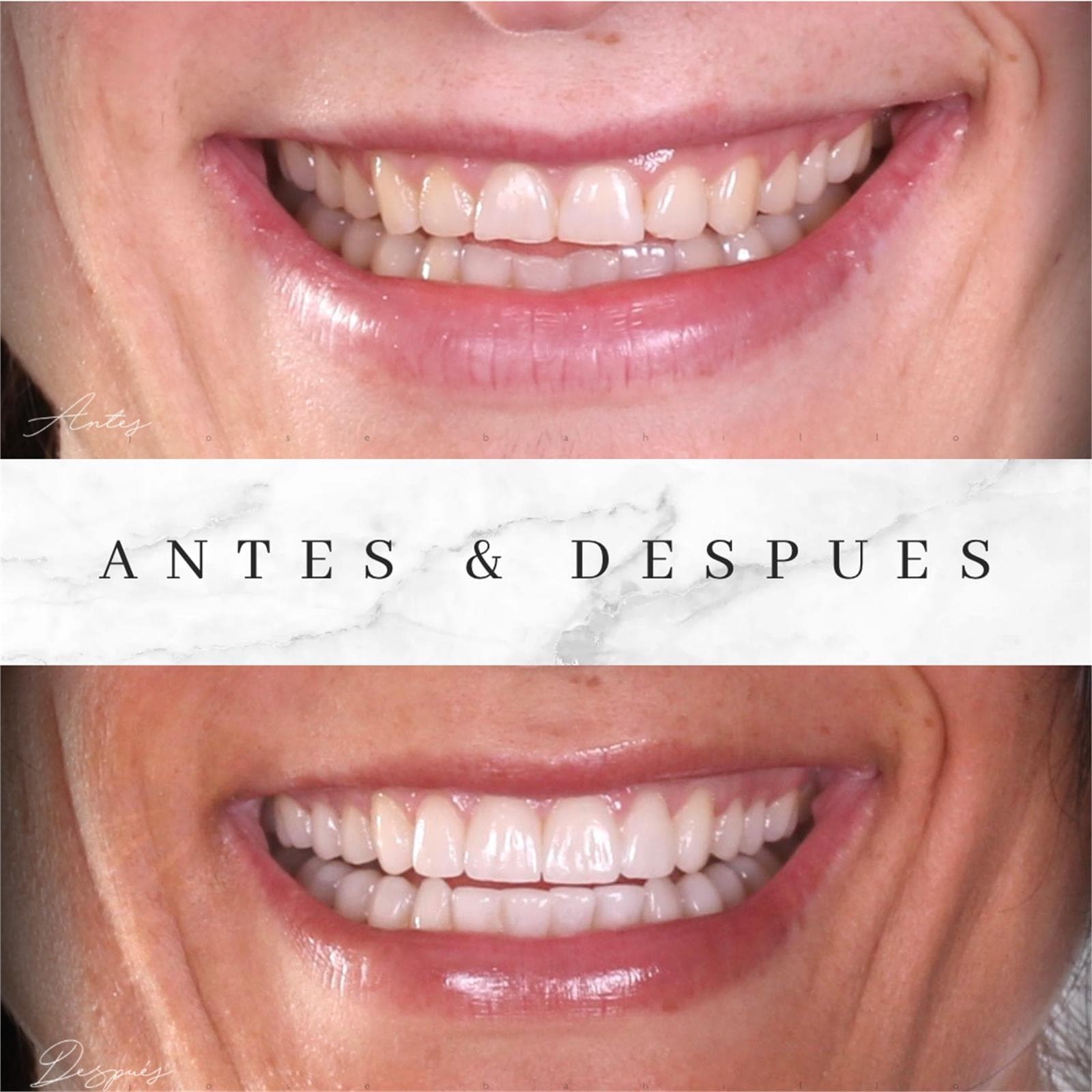 Estética Dental - Imagen 3