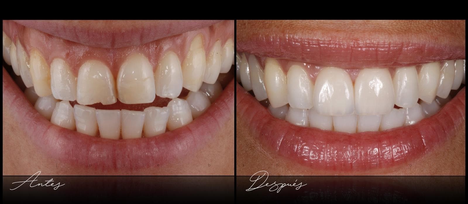 Estética Dental - Imagen 5