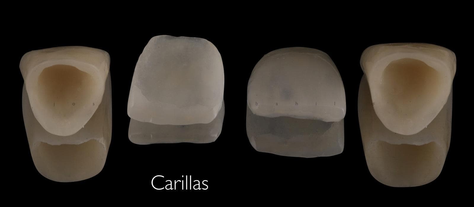 Estética Dental - Imagen 6