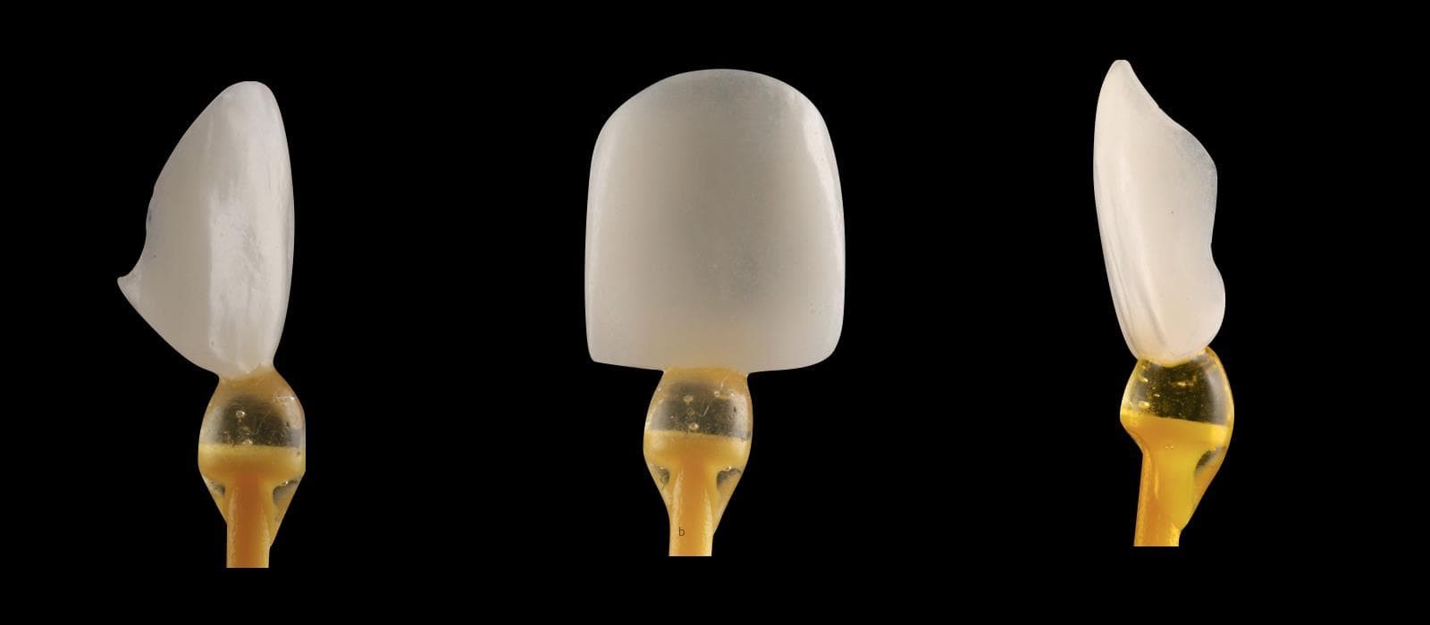 Estética Dental - Imagen 7
