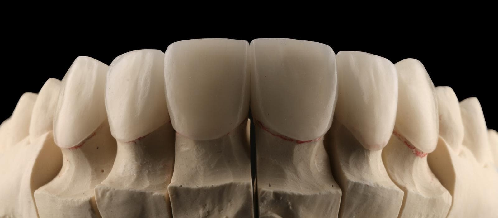 Estética Dental - Imagen 8