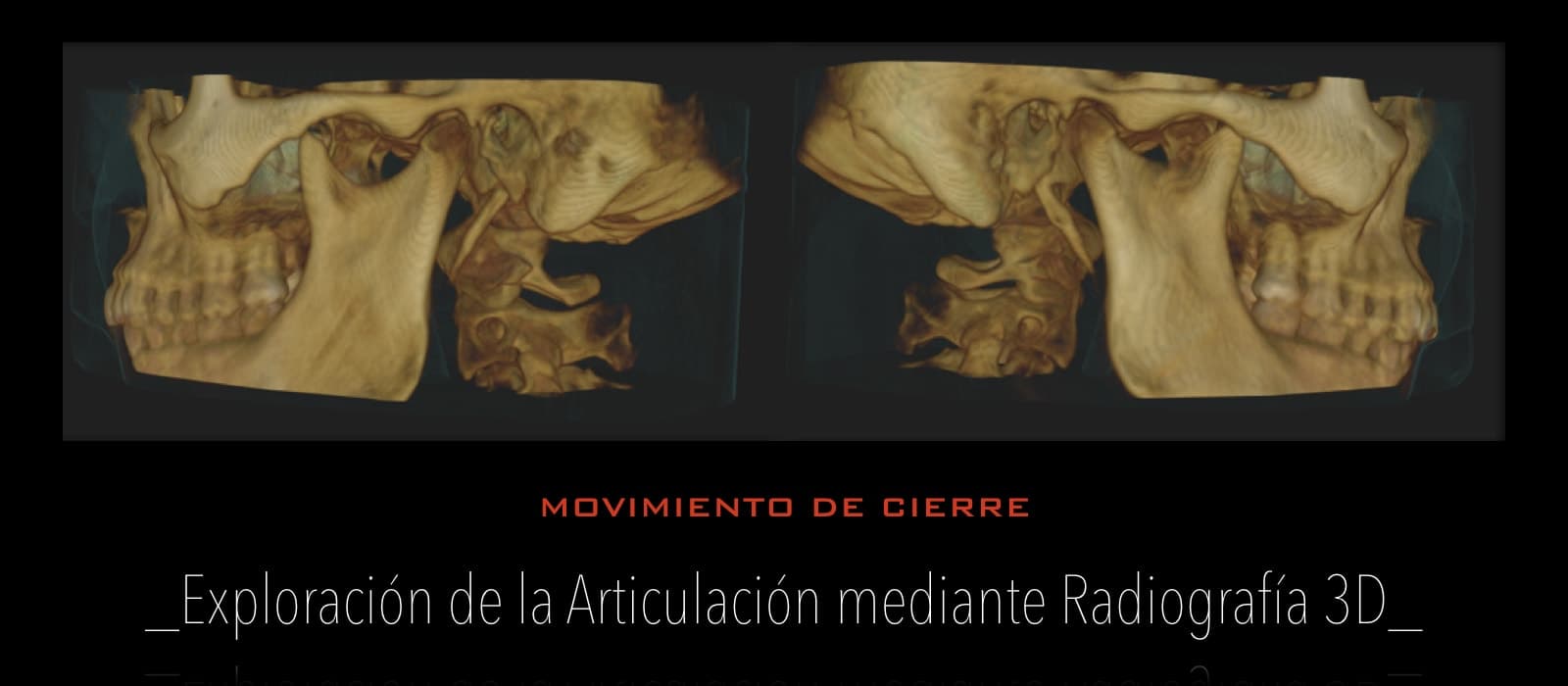 Articulación ATM - Policlínica Dental Bahillo
