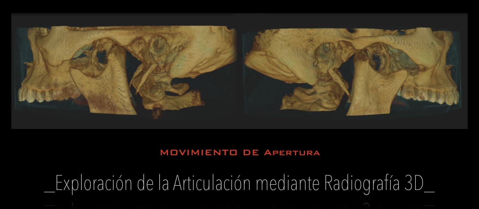 Articulación ATM - Policlínica Dental Bahillo