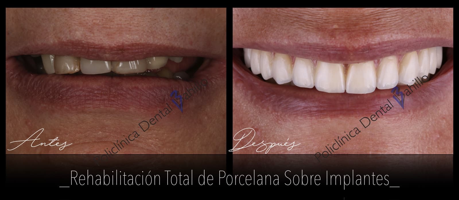 Cirugía - Policlínica Dental Bahillo