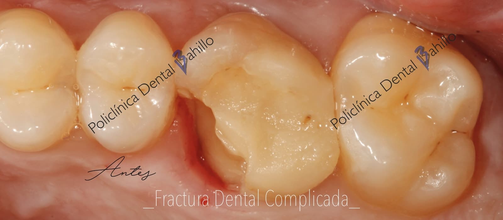 Cirugía - Policlínica Dental Bahillo
