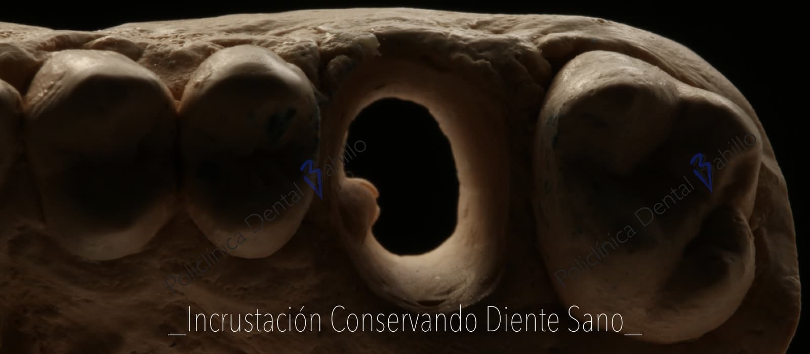 Cirugía - Policlínica Dental Bahillo