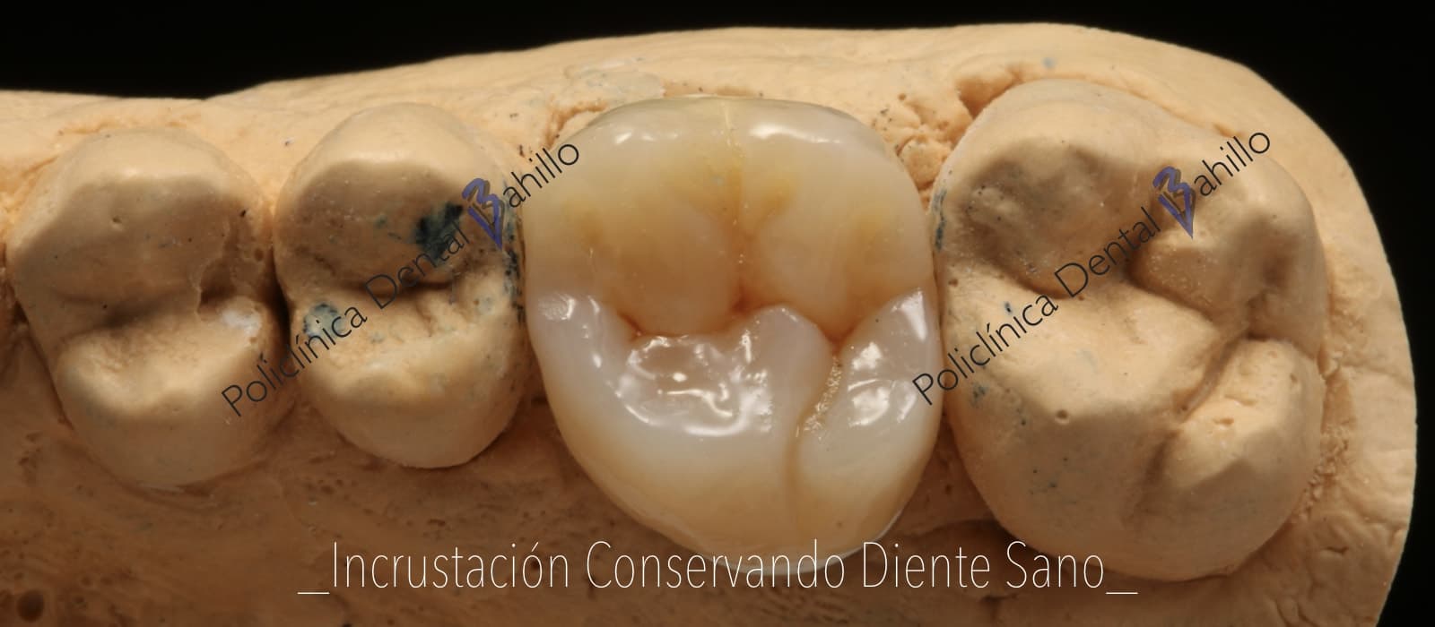 Cirugía - Policlínica Dental Bahillo