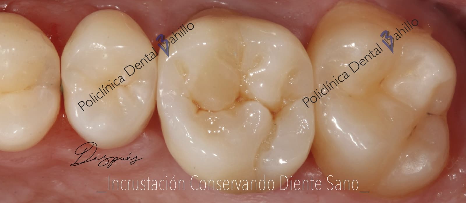 Cirugía - Policlínica Dental Bahillo