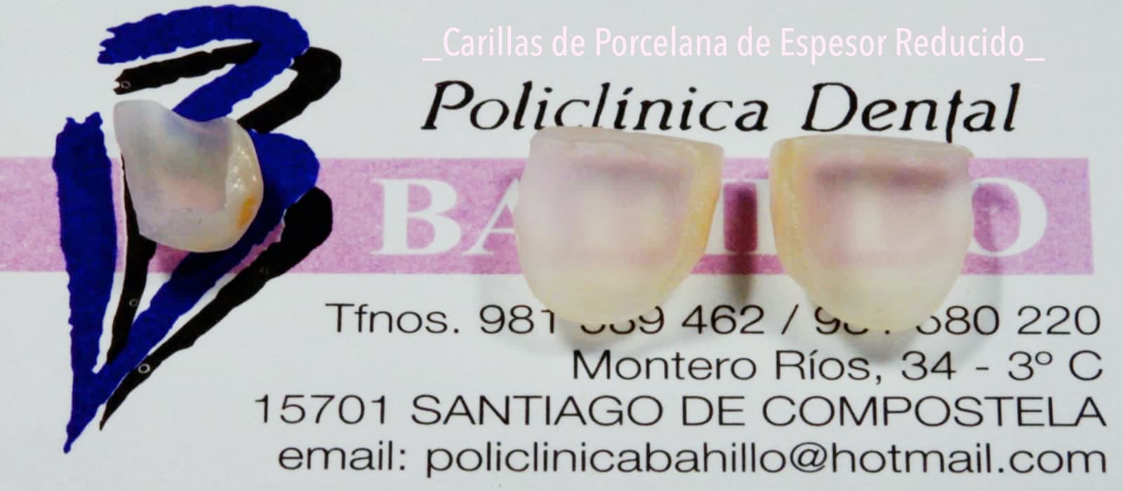 Estética dental - Policlínica Dental Bahillo