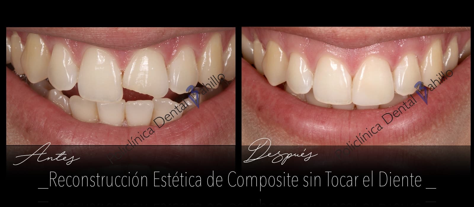 Odontología conservadora - Policlínica Dental Bahillo