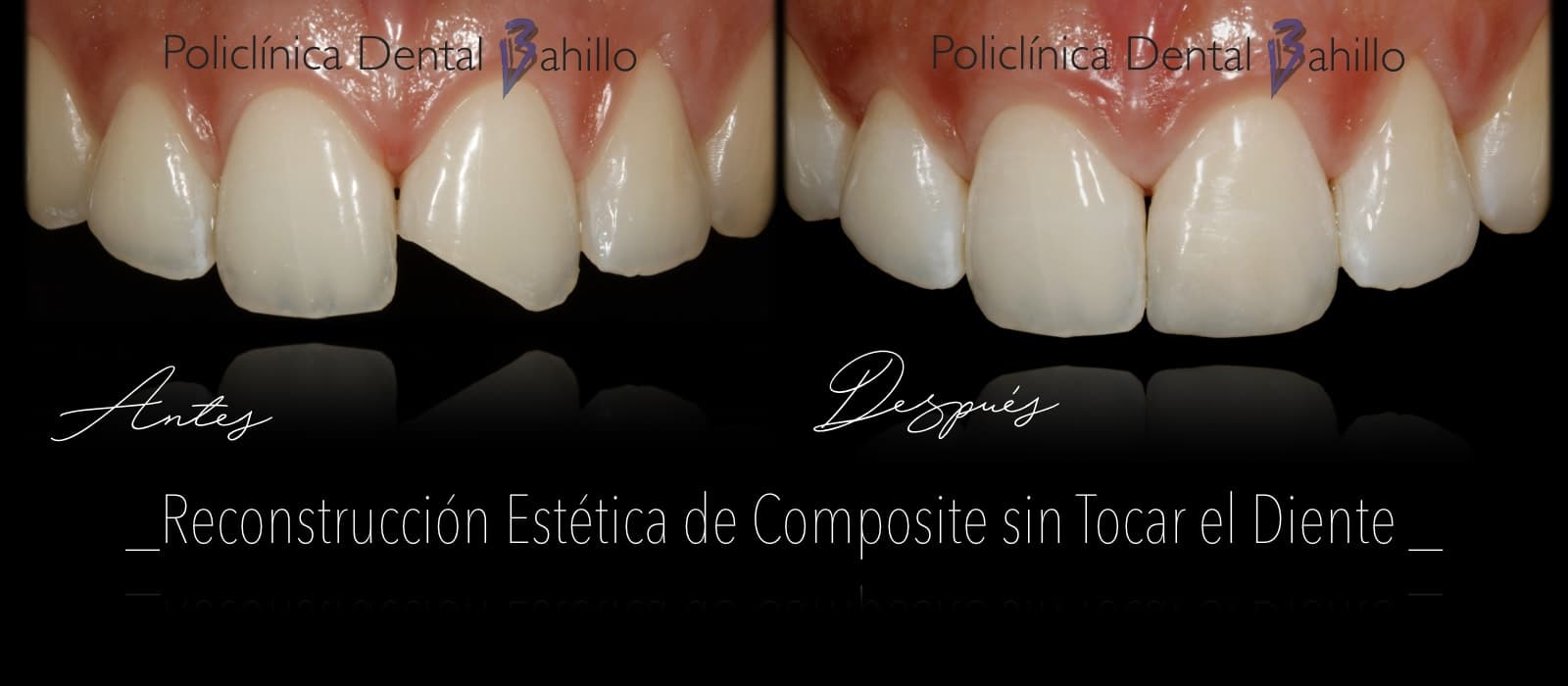 Odontología conservadora - Policlínica Dental Bahillo