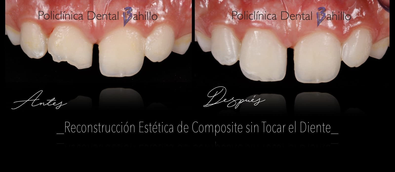 Odontopediatría - Policlínica Dental Bahillo