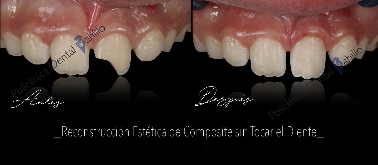 Odontopediatría - Policlínica Dental Bahillo