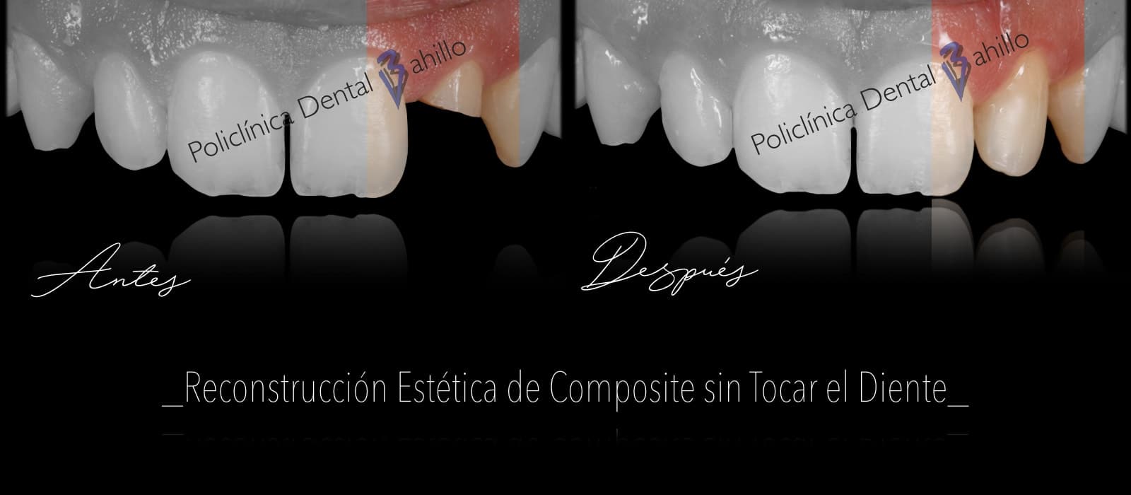Odontopediatría - Policlínica Dental Bahillo
