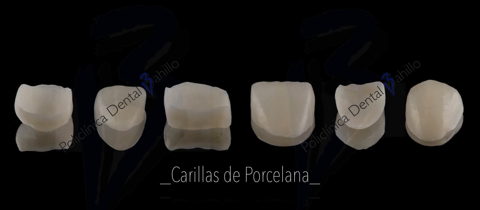 Ortodoncia - Policlínica Dental Bahillo