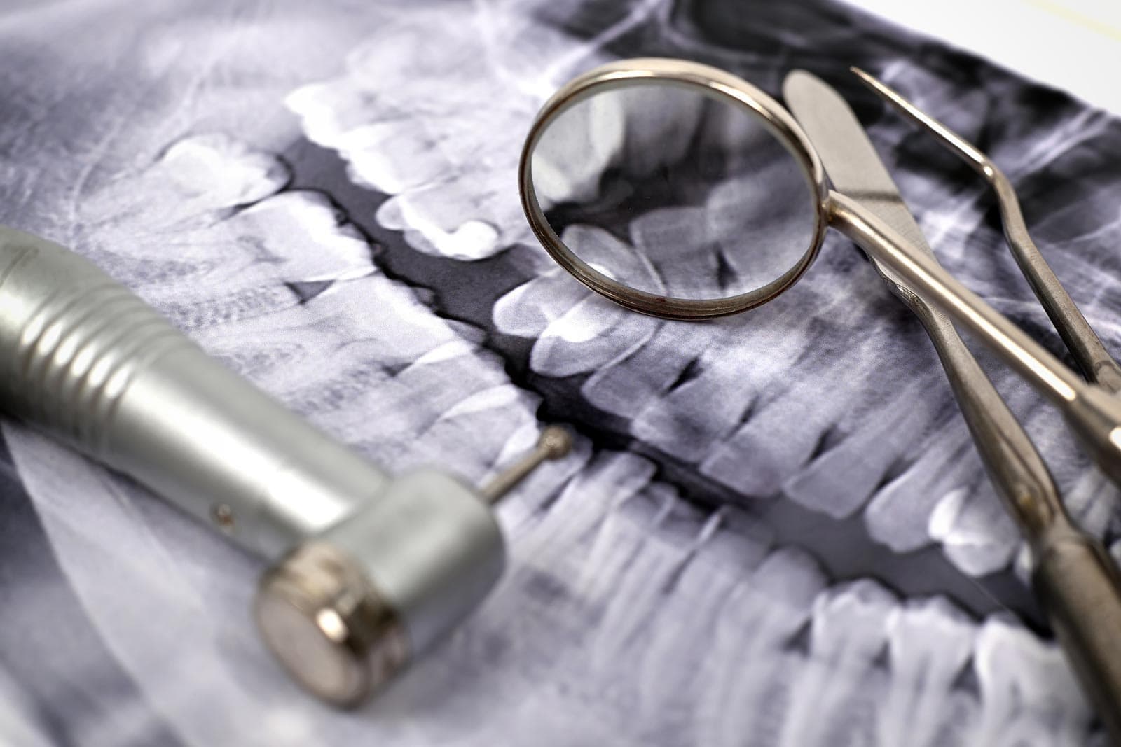 Tratamientos de estética dental en Santiago