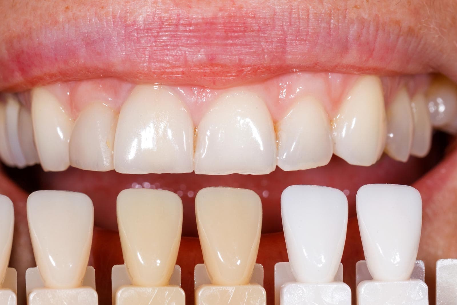 Clínica dental en Santiago
