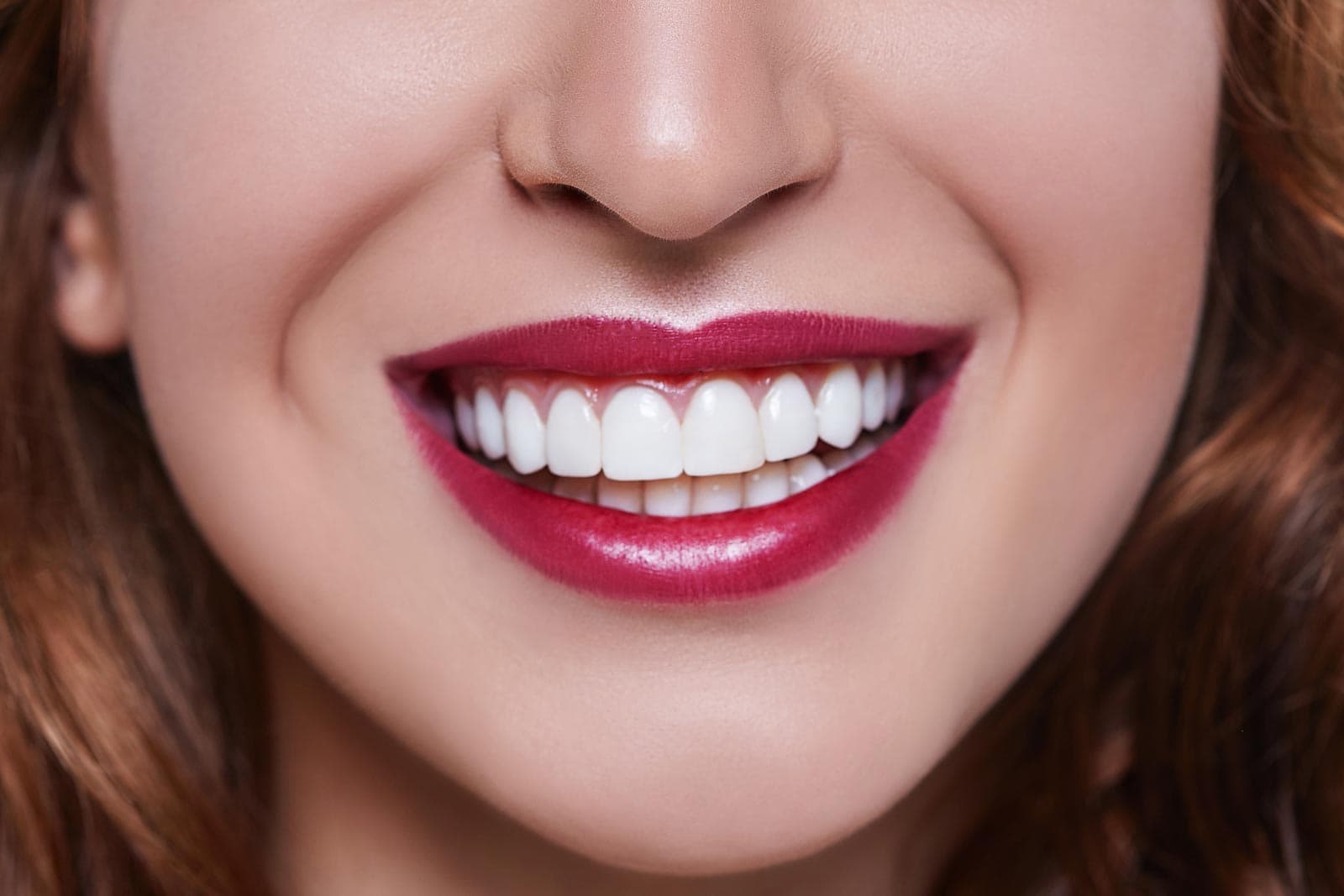 Tratamientos de estética dental en Santiago