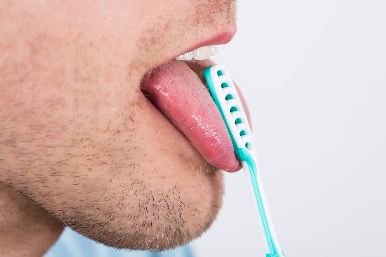 Tratamiento de la halitosis