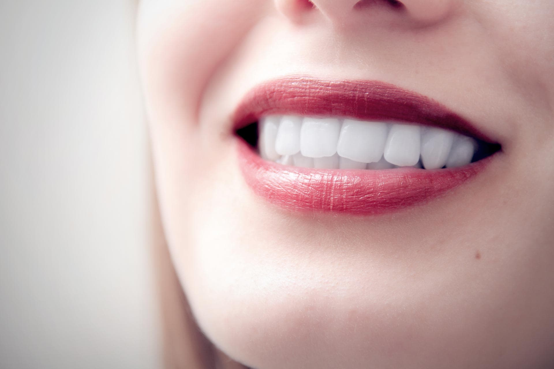 Estética dental