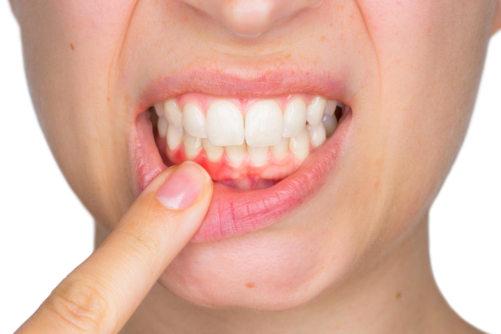 Tratamientos de periodoncia en Santiago de Compostela