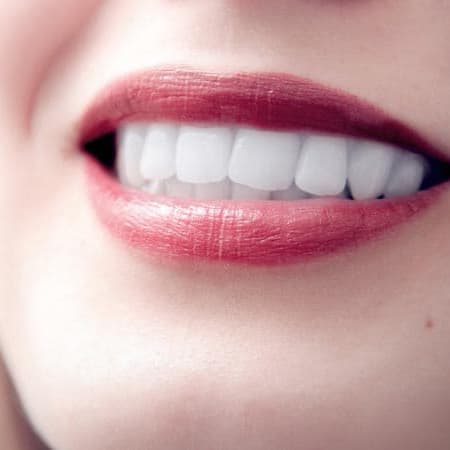 Tratamientos de estética dental en Santiago de Compostela