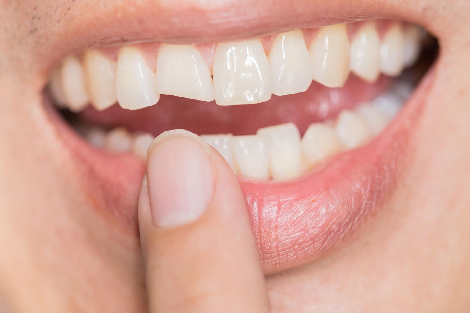 Especialistas en rehabilitación oral en Santiago de Compostela