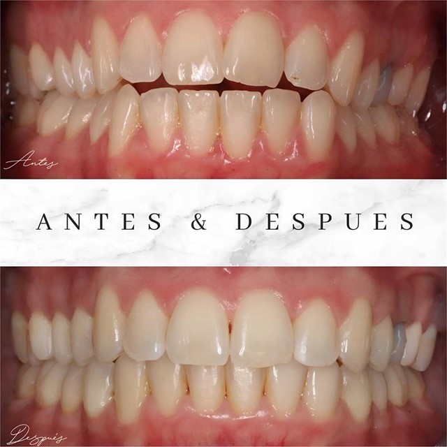 Implantology