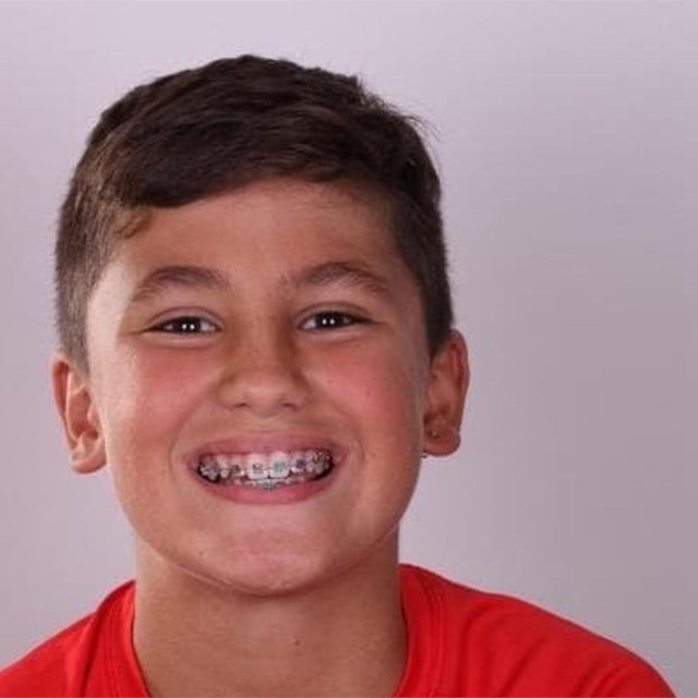 Ortodoncia Infantil