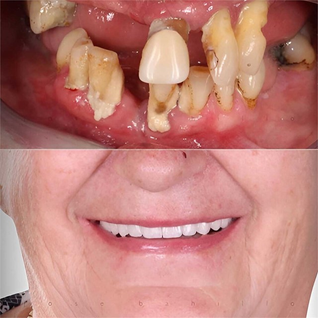 We improve your smile